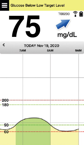 Glucose monitor displays "75 mg/dL" with a graph showing levels below target range on November 19, 2020.